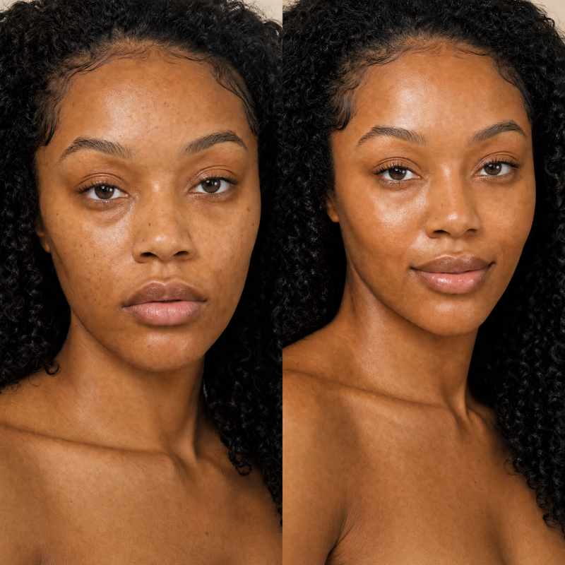 Fade dark spots in 14 days